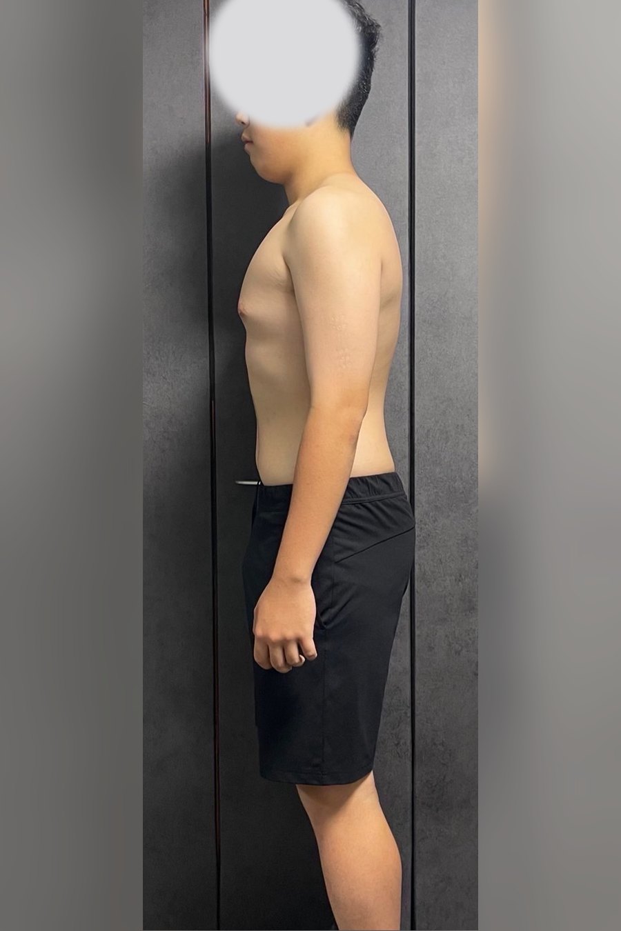 10代・男性 アフター