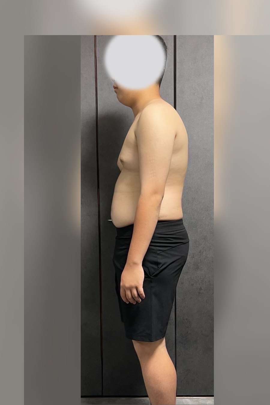 10代・男性 ビフォー