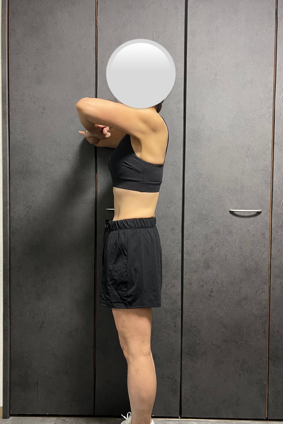 30代・女性 アフター